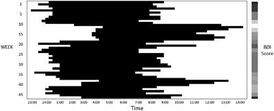 Rest–activity rhythm associated with depressive symptom severity and attention among patients with major depressive disorder: a 12-month follow-up study